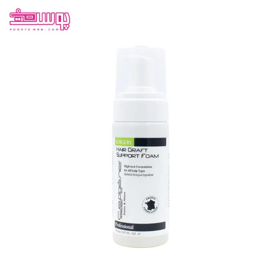 فوم پس از کاشت مو سپیژن حجم 75ml
