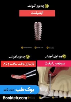 پکیج ویدئو ایمپلنت (1.ایمپلنت 2.سینوس لیفت 3.GBR) (انگلیسی)