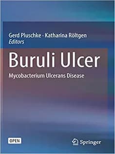 دانلود کتاب Buruli Ulcer: Mycobacterium Ulcerans Disease