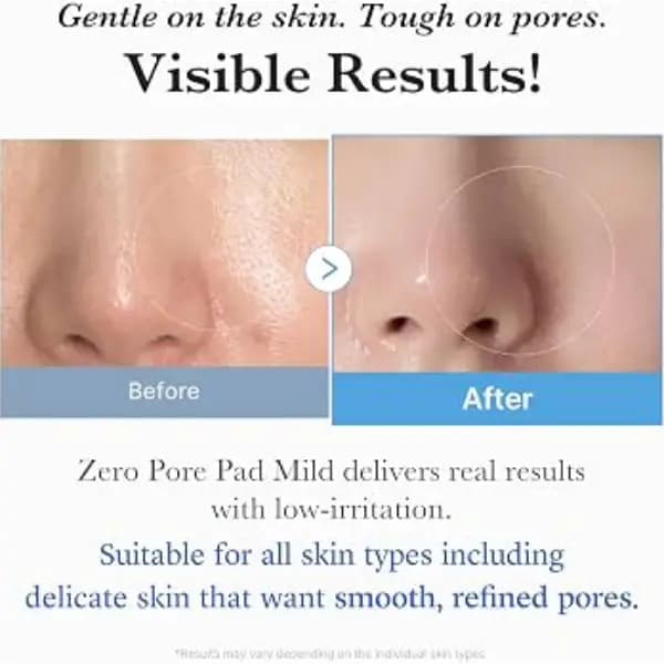 پد تونر لایه بردار و پاک کننده منافذ مدیکوب Medicube Zero Pore Pad — تصویر ۵