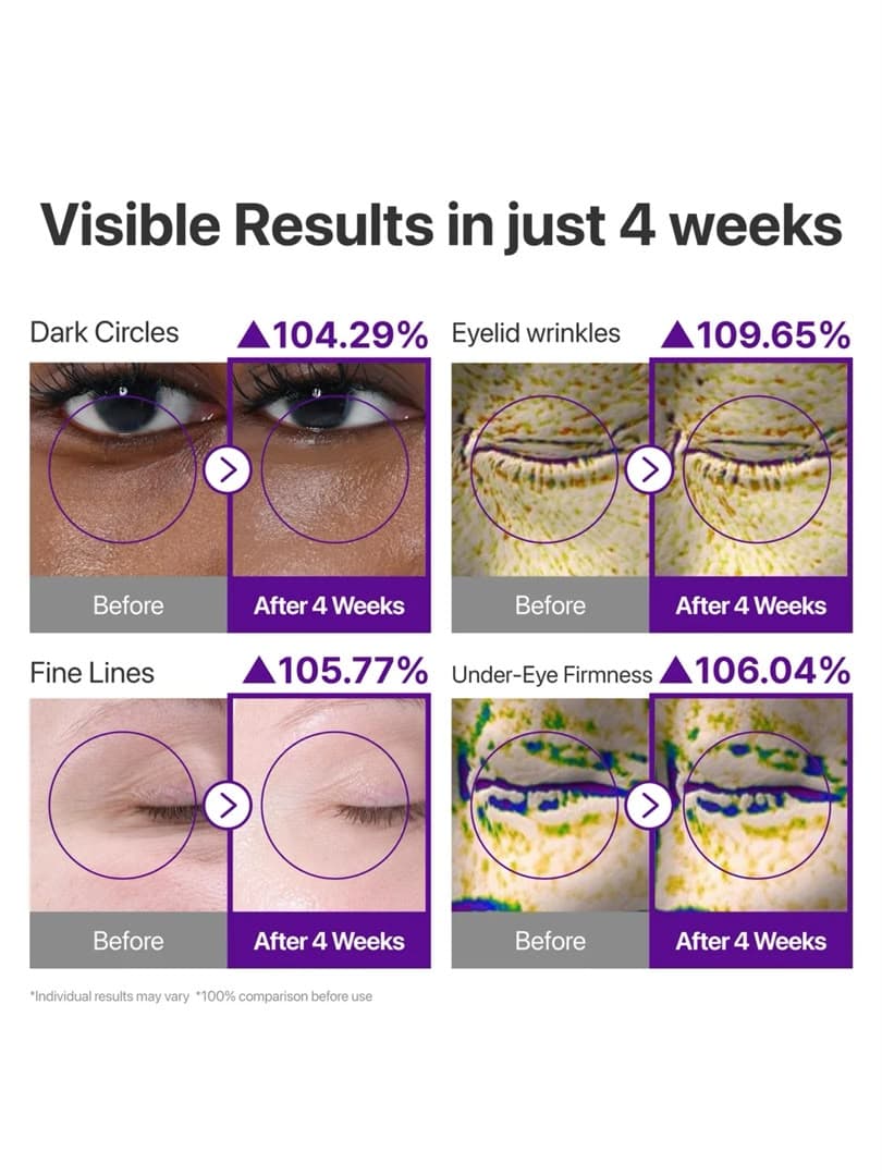 کرم دور چشم ضدچروک و لیفتینگ No\.9 NAD\+ Retinol Volumetox نامبوزین ۱۰ میلیلیتر — تصویر ۶