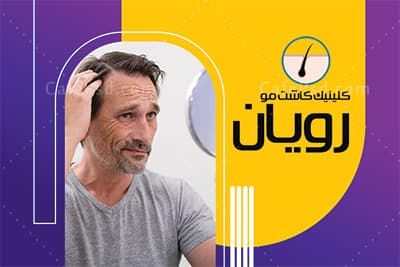 نمونه کارت ویزیت کاشت مو — تصویر ۲