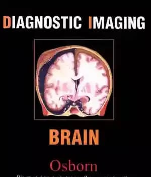دانلود کتاب Diagnostic Imaging Brain – تصویربرداری تشخیصی مغز