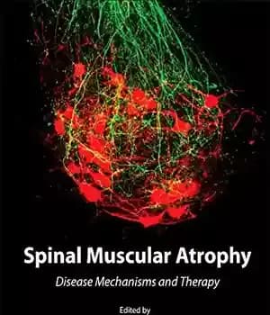 دانلود کتاب Spinal Muscular Atrophy. Disease Mechanisms and Therapy – آتروفی عضلانی نخاعی. مکانیسم های بیماری و درمان