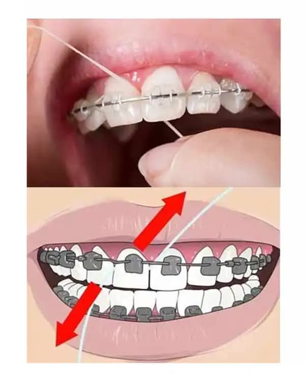نخ دندان ارتودنسی سوپر فلاس اورال بی OralB Super Floss اورجینال — تصویر ۴