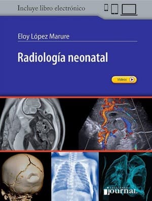 دانلود کتاب RADIOLOGÍA NEONATAL