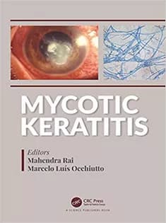 دانلود کتاب Mycotic Keratitis