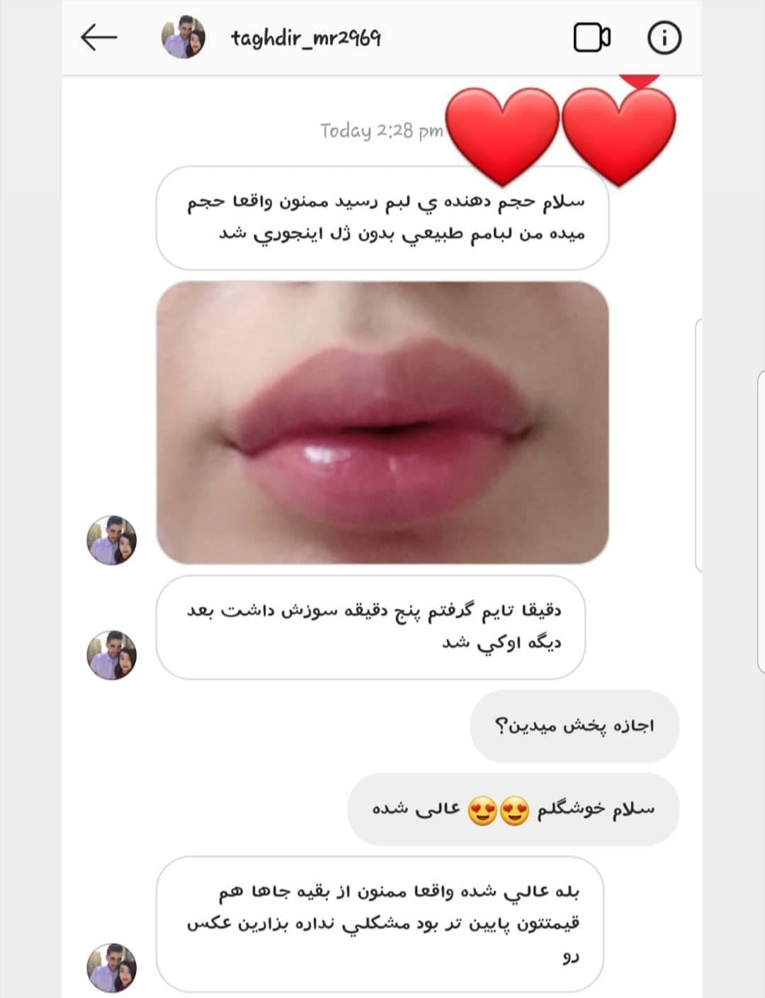 حجم دهنده لب پلامپ ایت Plump it! — تصویر ۴