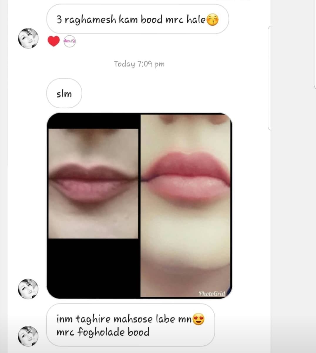 حجم دهنده لب پلامپ ایت Plump it! — تصویر ۳