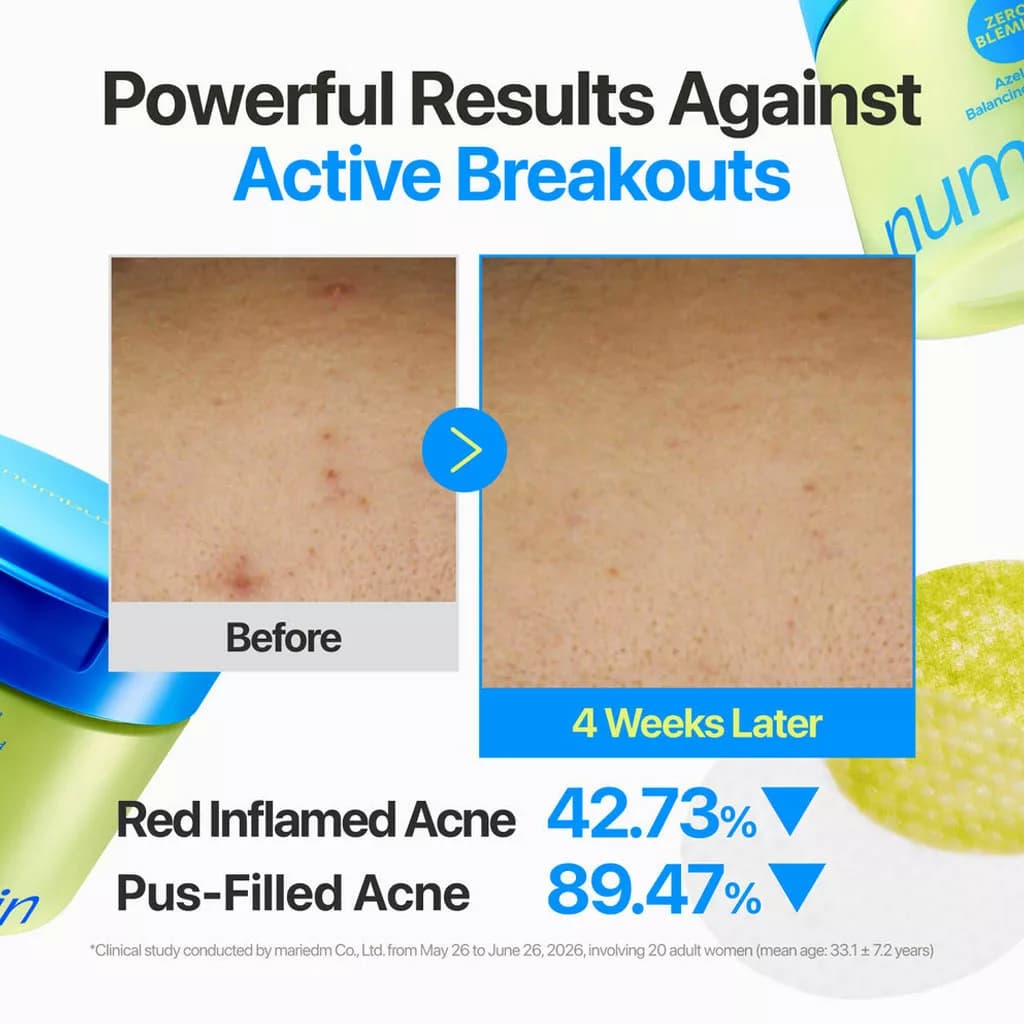 پد تونر ضد جوش آزلائیک اسید و سیکا زیرو بلمیش نامبوزین numbuzin Zero Blemish Azela Cica Balancing Dual Pads — تصویر ۱۱