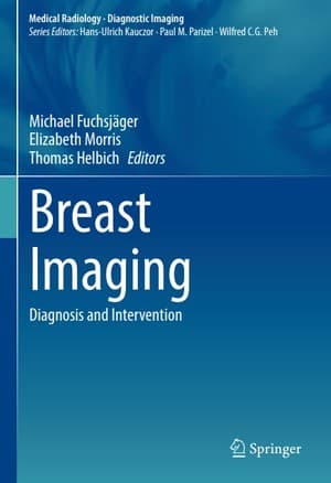 دانلود کتاب Breast Imaging Diagnosis and Intervention-Springer