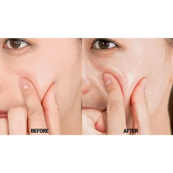 آمپول ضد چروک و حجم‌دهنده پپتید ۹ مدی پیل MediPeel — تصویر ۴