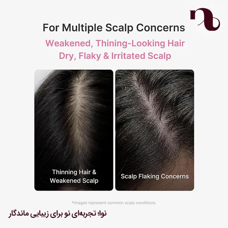 سرم رزماری مدیکوب ضدریزش و تقویت کننده پوست سر medicube Rosemary PDRN Scalp Serum — تصویر ۷