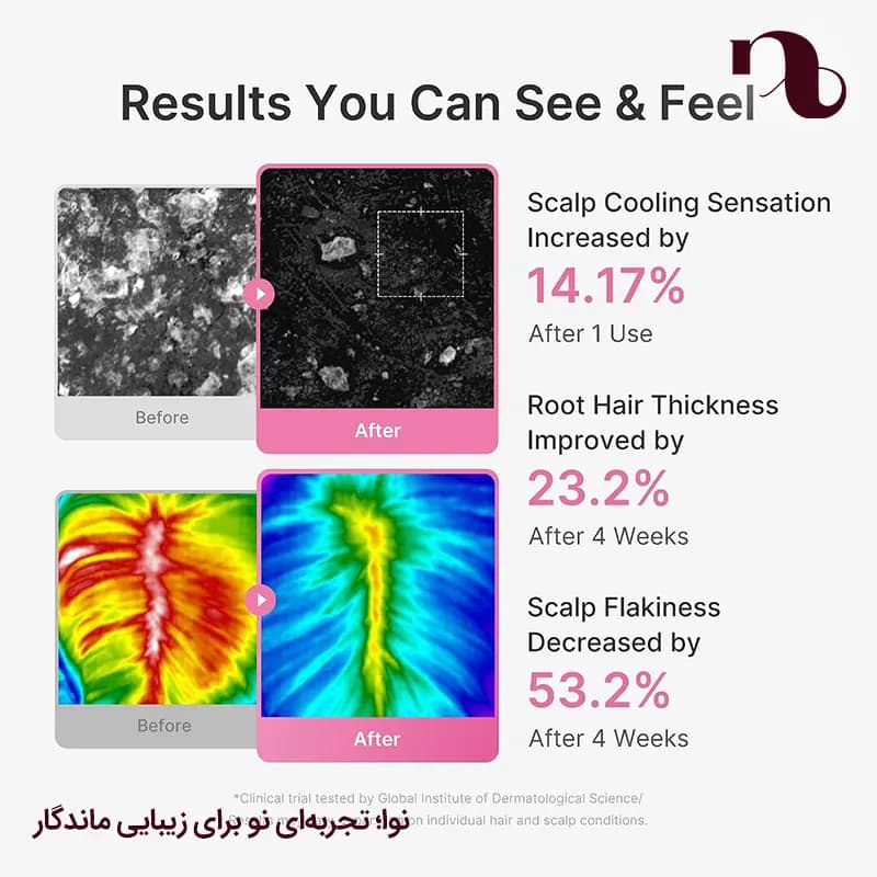 سرم رزماری مدیکوب ضدریزش و تقویت کننده پوست سر medicube Rosemary PDRN Scalp Serum — تصویر ۳
