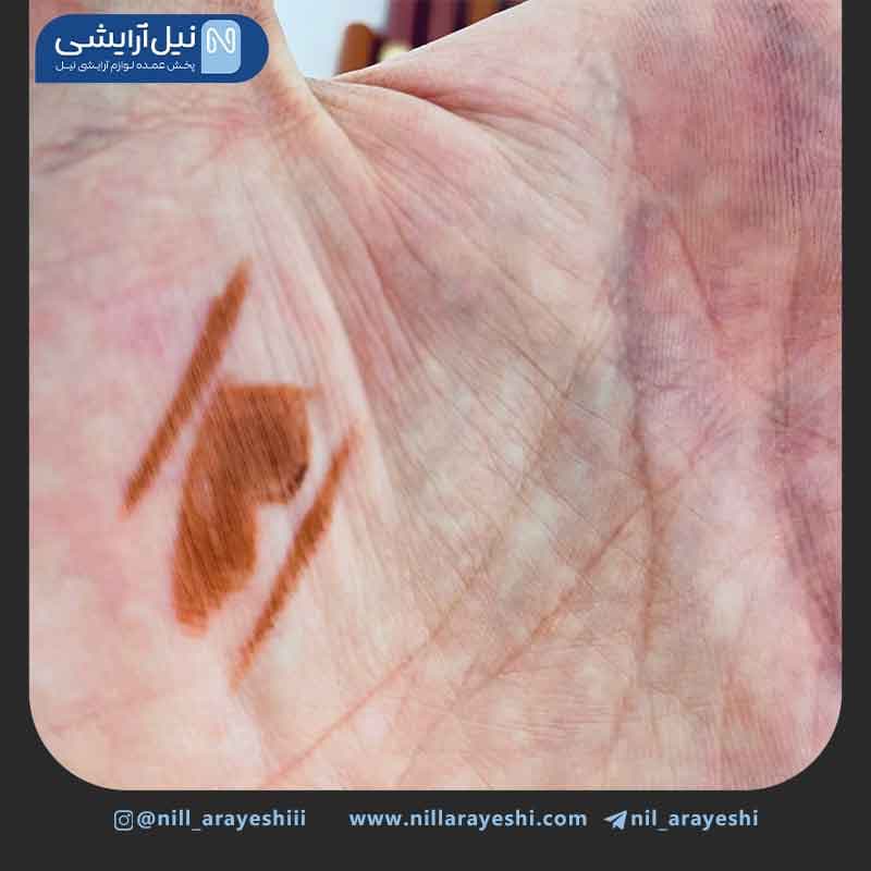 خط لب کاریته — تصویر ۳