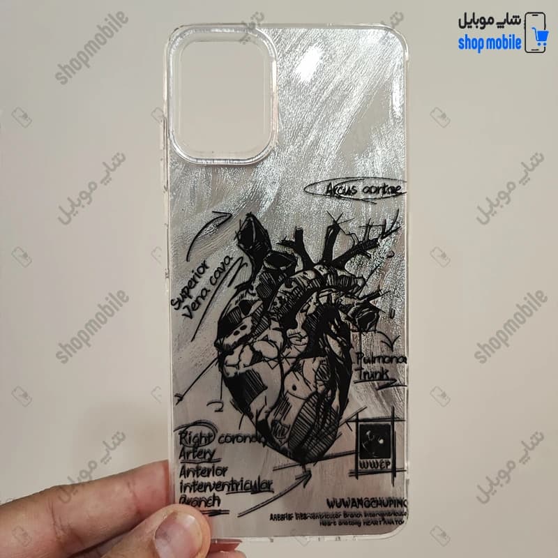 قاب گوشی سامسونگ گلکسی A51 (کاور IMD براش طرح آناتومی قلب Silver)