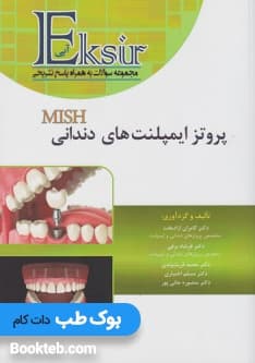 اکسیر آبی پروتز ایمپلنت های دندانی میش 2015