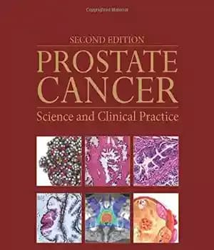 دانلود کتاب Prostate Cancer, Second Edition: Science and Clinical Practice – سرطان پروستات، ویرایش دوم: علم و عمل بالینی