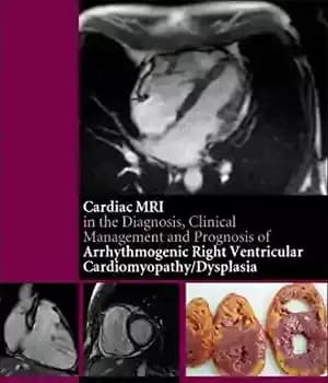دانلود کتاب The cardiac MRI in diagnosis, clinical management, and prognosis of arrhythmogenic right ventricular cardiomyopathy/dysplasia – MRI قلب در…