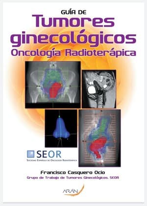 دانلود کتاب Guia de tumores ginecológicos