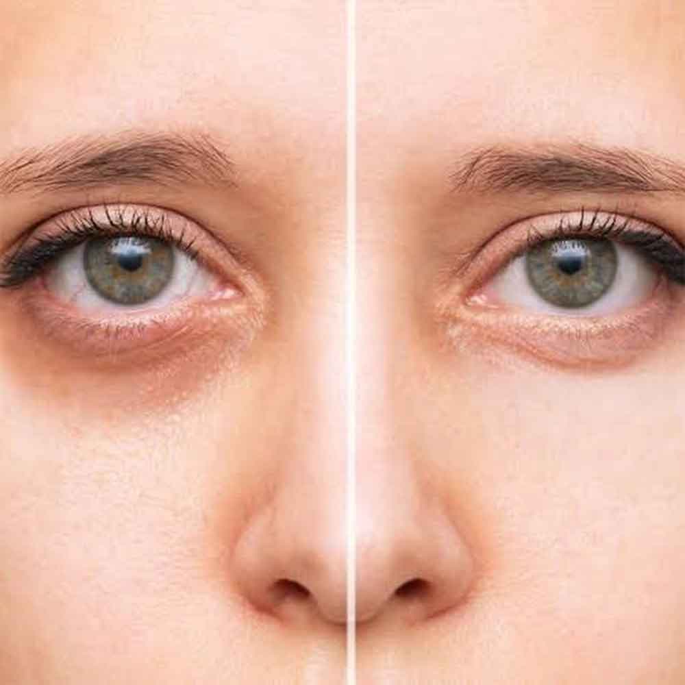 کانسیلر مایع آرت اسکین Artskin مدل Crayon Corrector حجم 10 میلی لیتر — تصویر ۳