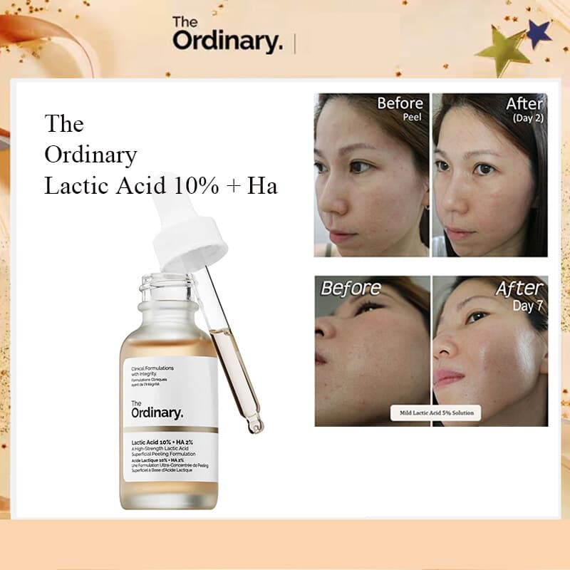 سرم لایه بردار اوردینری مدل لاکتیک اسید 5% The ordinary Lactic Acid — تصویر ۲