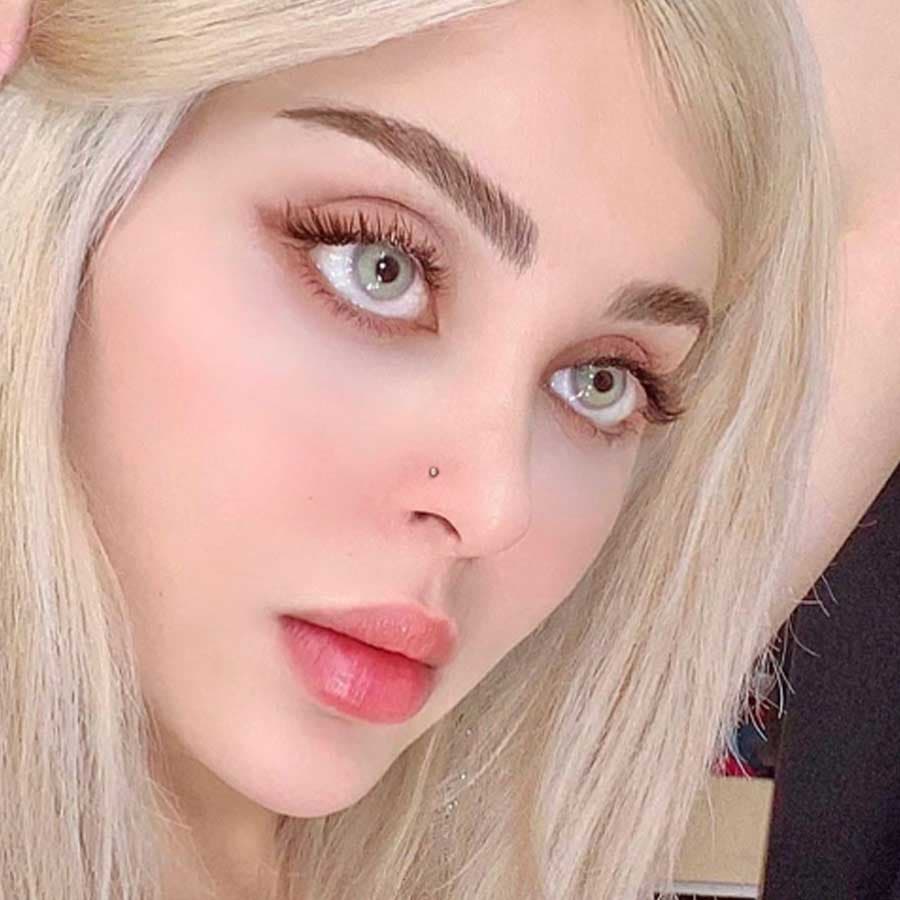 لنز طبی رنگی گری سالانه — تصویر ۲