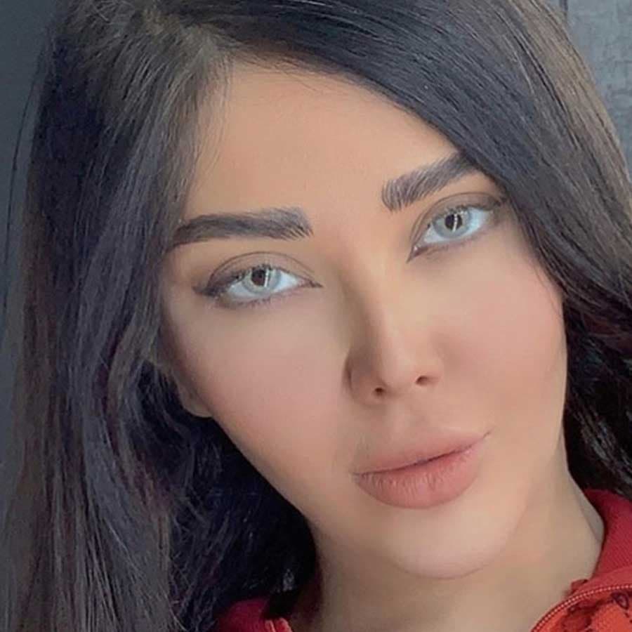 لنز رنگی ترسا کاملیا سالانه — تصویر ۲