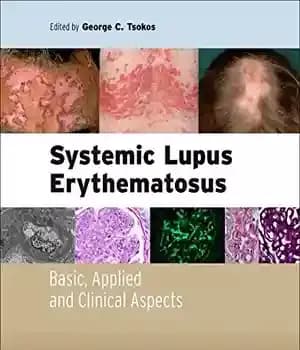 دانلود کتاب Systemic lupus erythematosus : basic, applied and clinical aspects – لوپوس اریتماتوز سیستمیک: جنبه های اساسی، کاربردی و…
