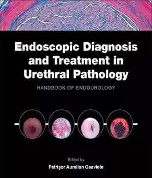 دانلود کتاب Endoscopic diagnosis and treatment in urethral pathology : handbook of endourology – تشخیص و درمان آندوسکوپی در آسیب…