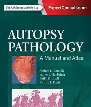 دانلود کتاب Autopsy Pathology: A Manual and Atlas, 3e – آسیب شناسی کالبد شکافی: راهنما و اطلس، 3e