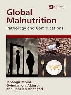 دانلود کتاب Global Malnutrition: Pathology and Complications