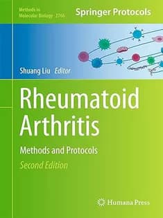 دانلود کتاب Rheumatoid Arthritis: Methods and Protocols (Volume 2766)