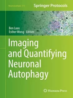 دانلود کتاب Imaging and Quantifying Neuronal Autophagy
