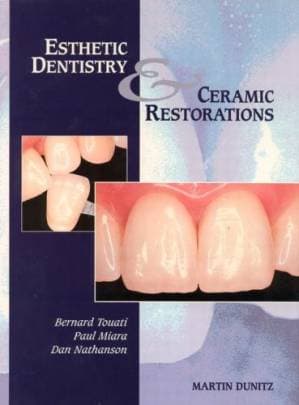 دانلود کتاب Esthetic Dentistry and Ceramic Restorations