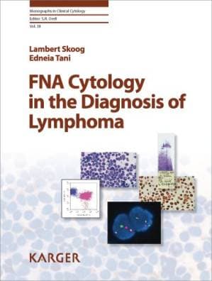 دانلود کتاب FNA Cytology in the Diagnosis of Lymphoma (Monographs in Clinical Cytology Vol 18)