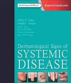 دانلود کتاب Dermatological Signs of Systemic Disease – علائم پوستی بیماری سیستمیک
