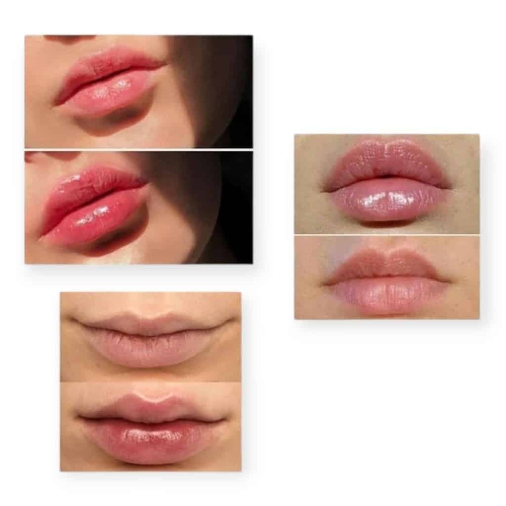 حجم دهنده لب گابرینی Gabrini lip volume — تصویر ۲