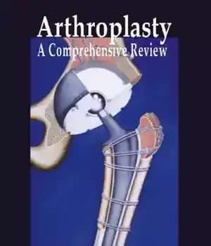 دانلود کتاب Arthroplasty A Comprehensive Review – Arthroplasty یک بررسی جامع