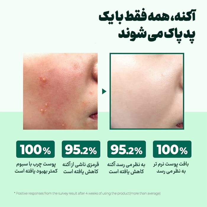 پد ضد جوش و لایه بردار سام بای می — تصویر ۲