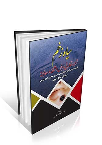 سیاه زخم