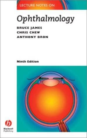 دانلود کتاب Lecture Notes on Ophthalmology (Lecture Notes Series (Blackwell Scientific Publications).)
