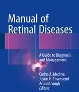 دانلود کتاب Manual of Retinal Diseases: A Guide to Diagnosis and Management – کتابچه راهنمای بیماریهای شبکیه: راهنمای تشخیص و…