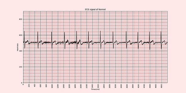 نمایش سیگنال ECG در Python