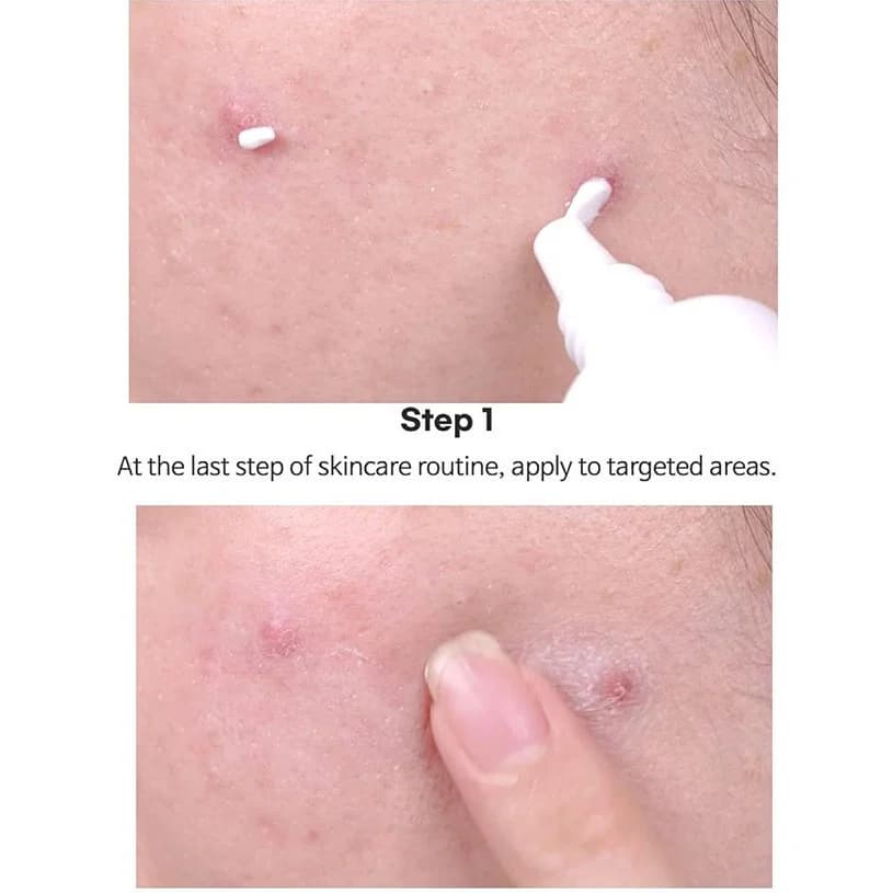 کرم نقطهای ضدلک و ضد جوش تیام مدل AC Fighting Spot RX Cream حجم 30 گرم — تصویر ۴