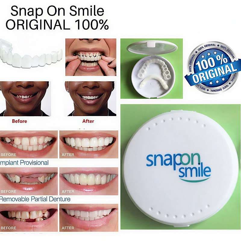 لمینت دندان دو فک مدل Snap on Smile کد N694 — تصویر ۵