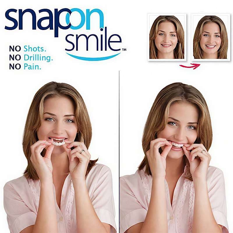 لمینت دندان دو فک مدل Snap on Smile کد N694 — تصویر ۶