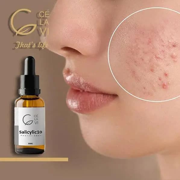 سرم سالیسیلیک اسید 10 درصد سلاوی 30 میل — تصویر ۵