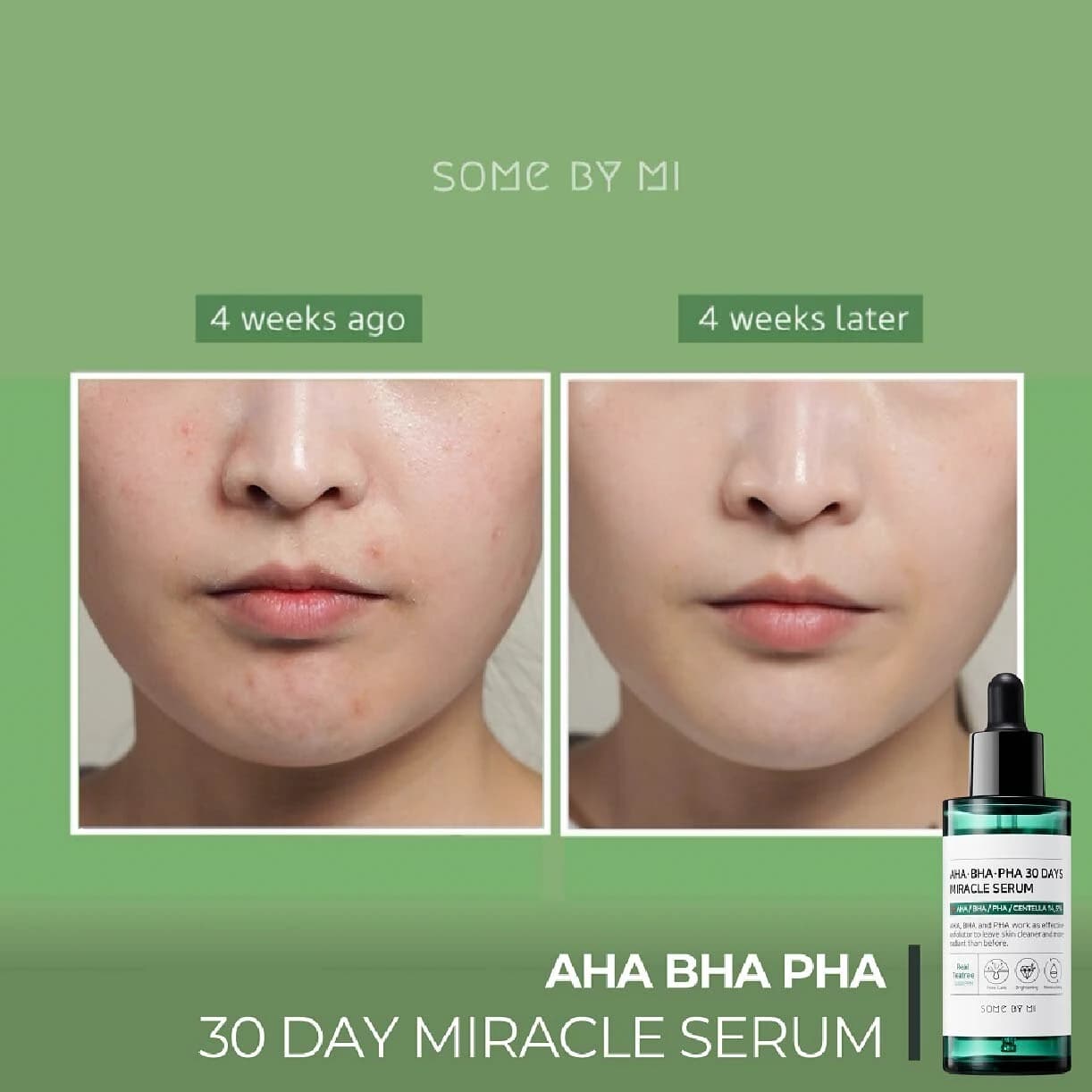 سرم معجزه آسای ۳۰ روزه سام بای می | SOME BY MI AHA.BHA.PHA 30 DAYS MIRACLE SERUM 50 ml — تصویر ۳