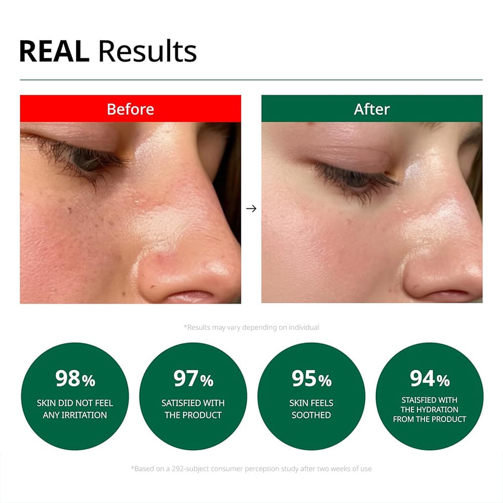 کرم تسکین‌دهنده و شفاف‌کننده لکه‌های قرمز دکتر جی | Dr.G Red Blemish Clear Soothing Cream — تصویر ۲